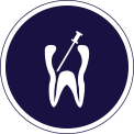 Root Canal Service